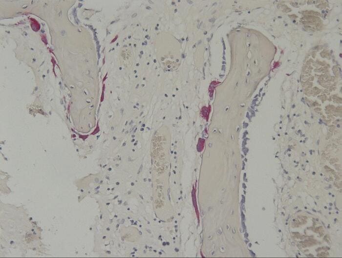 Image of TRAP stain for Osteoblast_rabbit bone